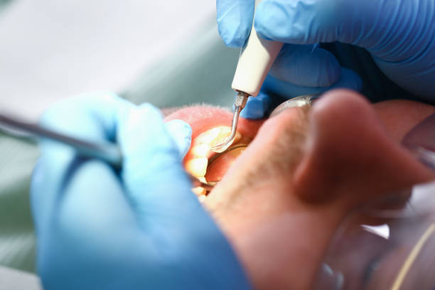 Best Emergency Dentist for Knocked-Out Tooth in Stonecrest, GA