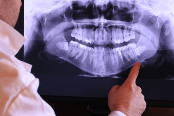 Best Emergency Root Canal Treatment in Stonecrest, GA