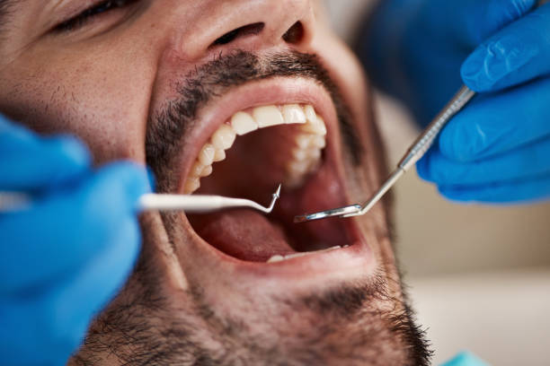 Best Emergency Dental Care for Abscessed Tooth in Stonecrest, GA